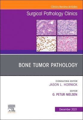 bokomslag Bone Tumor Pathology, An Issue of Surgical Pathology Clinics