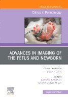 Sangam Kanekar, Sarah Sarvis Milla - Advances in Neuroimaging of the Fetus and Newborn, An Issue of Clinics in Perinatology, Inbunden