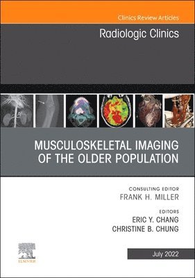 bokomslag Musculoskeletal Imaging of the Older Population, An Issue of Radiologic Clinics of North America