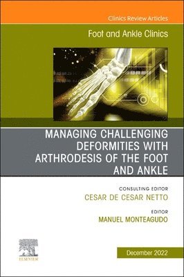 Managing Challenging deformities with arthrodesis of the foot and ankle, An issue of Foot and Ankle Clinics of North America 1