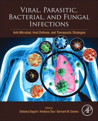 Viral, Parasitic, Bacterial, and Fungal Infections 1