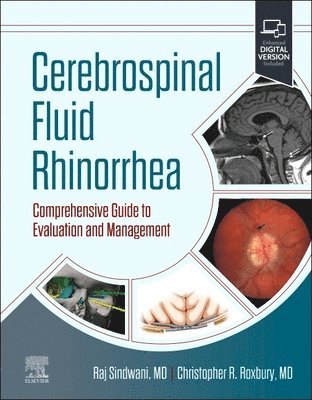 Cerebrospinal Fluid Rhinorrhea 1