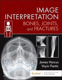 bokomslag Image Interpretation: Bones, Joints, and Fractures