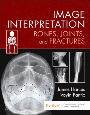 bokomslag Image Interpretation: Bones, Joints, and Fractures