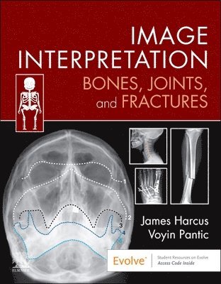 Image Interpretation: Bones, Joints, and Fractures