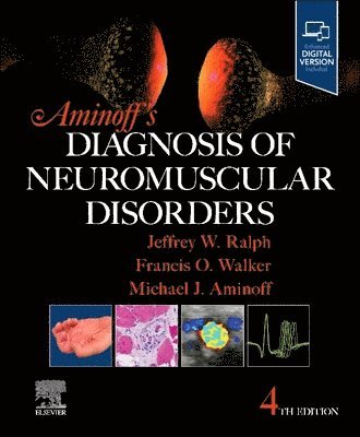 Aminoff's Diagnosis of Neuromuscular Disorders 1