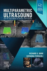 bokomslag Multiparametric Ultrasound for the Assessment of Diffuse Liver Disease