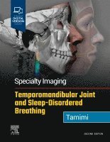 Dania Tamimi - Specialty Imaging: Temporomandibular Joint and Sleep-Disordered Breathing, Inbunden