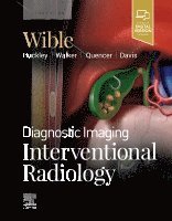Brandt C. Wible, USA) Wible, Brandt C. (Associate Professor, Section Head, Vascular & Interventional Radiology, University of Missouri-Kansas City, Saint Luke's Hospital, Kansas City, Missouri - Diagnostic Imaging: Interventional Radiology, Inbunden