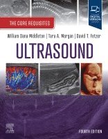William Dana Middleton, Tara A. Morgan, David T. Fetzer - Ultrasound: The Core Requisites, Häftad