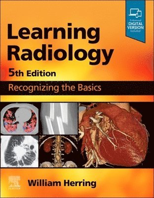 William Herring, USA) Herring, William (Vice Chairman and Residency Program Director, Albert Einstein Medical Center, Philadelphia, PA - Learning Radiology, Häftad