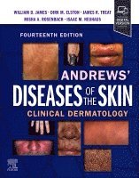 William D. James, Dirk M. Elston, James R. Treat, Misha Rosenbach - Andrews' Diseases of the Skin, Inbunden