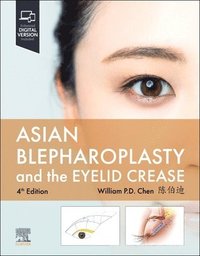 bokomslag Asian Blepharoplasty and the Eyelid Crease