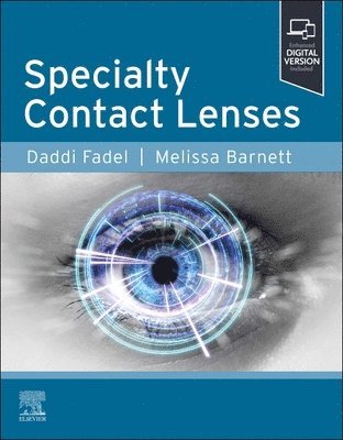 Specialty Contact Lenses 1