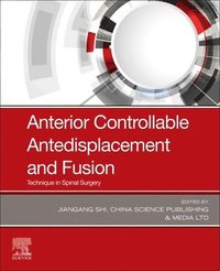 bokomslag Anterior Controllable Antedisplacement and Fusion