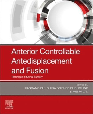 Jiangang Shi, China) Shi, Jiangang (Chief Physician, Department of Spine Surgery in Changzheng Hospital, and Chairman of Academic Association - Anterior Controllable Antedisplacement and Fusion, Häftad