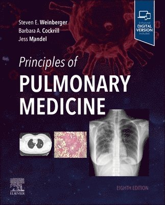 bokomslag Principles of Pulmonary Medicine