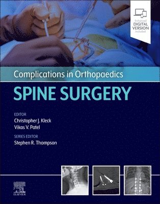 Vikas Patel, Christopher J. Kleck, Christopher J Kleck, Stephen R Thompson - Complications in Orthopaedics: Spine Surgery, Inbunden