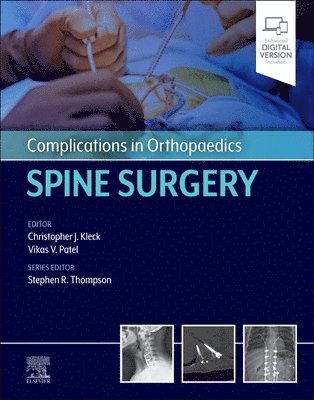 Complications in Orthopaedics: Spine Surgery 1