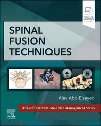 bokomslag Spinal Fusion Techniques