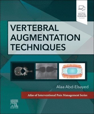 bokomslag Vertebral Augmentation Techniques