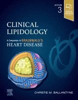 Christie M. Ballantyne - Clinical Lipidology, Inbunden