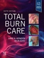 bokomslag Total Burn Care