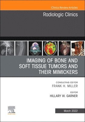 Imaging of Bone and Soft Tissue Tumors and Their Mimickers, An Issue of Radiologic Clinics of North America 1