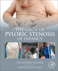 bokomslag The Cause of Pyloric Stenosis of Infancy