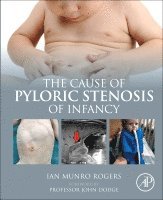 bokomslag The Cause of Pyloric Stenosis of Infancy