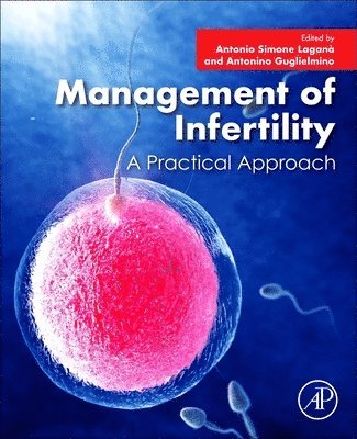 bokomslag Management of Infertility