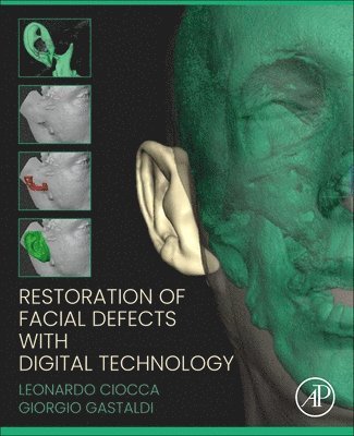 Restoration of Facial Defects with Digital Technology 1