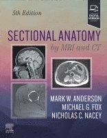 Mark W. Anderson, Michael G. Fox, Nicholas C. Nacey - Sectional Anatomy by MRI and CT, Inbunden