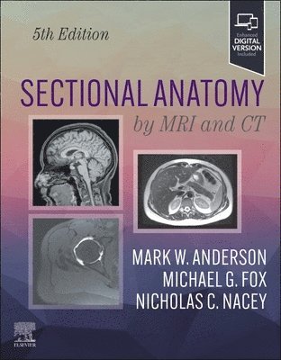 Sectional Anatomy by MRI and CT 1