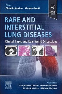 bokomslag Rare and Interstitial Lung Diseases