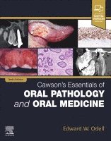 bokomslag Cawson's Essentials of Oral Pathology and Oral Medicine