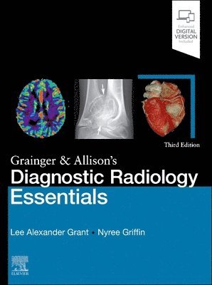 Lee A. Grant, Nyree Griffin, UK) Grant, Lee A. (Consultant Radiologist, The Royal Free NHS Foundation Trust, London, UK) Griffin, Nyree (Consultant Radiologist, Guy's and St Thomas' NHS Foundation Trust, London, Lee A Grant - Grainger & Allison's Diagnostic Radiology Essentials, Inbunden