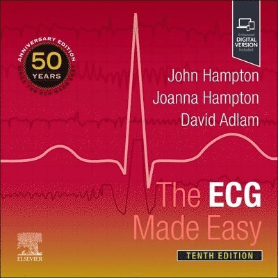 The ECG Made Easy 1