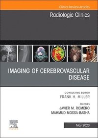 bokomslag Imaging of Cerebrovascular Disease, An Issue of Radiologic Clinics of North America