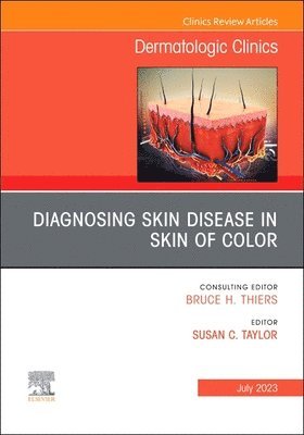 bokomslag Diagnosing Skin Disease in Skin of Color, An Issue of Dermatologic Clinics