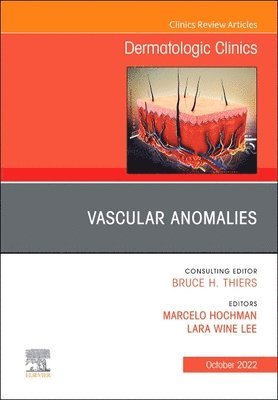 Vascular Anomalies, An Issue of Dermatologic Clinics 1