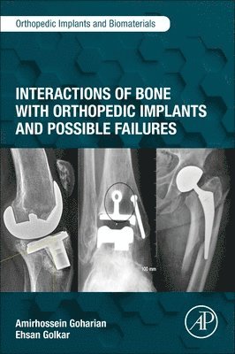 bokomslag Interactions of Bone with Orthopedic Implants and Possible Failures