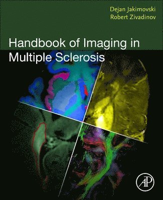 bokomslag Handbook of Imaging in Multiple Sclerosis