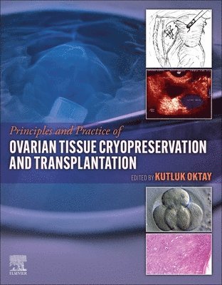 Kutluk Oktay, USA) Oktay, Kutluk (Laboratory of Molecular Reproduction and Fertility Preservation, Yale School of Medicine, New Haven, CT - Principles and Practice of Ovarian Tissue Cryopreservation and Transplantation, Inbunden