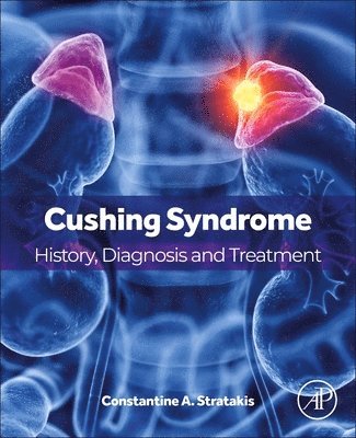 Cushing Syndrome 1