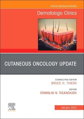 Cutaneous Oncology Update, An Issue of Dermatologic Clinics 1