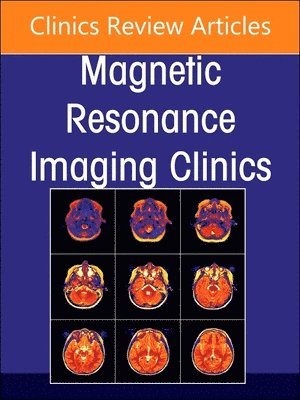 MR Imaging of the Adnexa, An Issue of Magnetic Resonance Imaging Clinics of North America 1