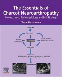 bokomslag The Essentials of Charcot Neuroarthropathy