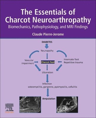 The Essentials of Charcot Neuroarthropathy 1