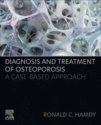 bokomslag Diagnosis and Treatment of Osteoporosis